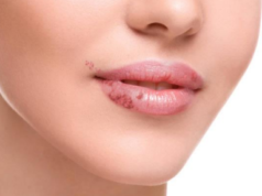 Jak dostat opar zpět do klidu: Praktické tipy na stravu